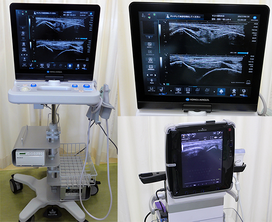 超音波画像診断装置